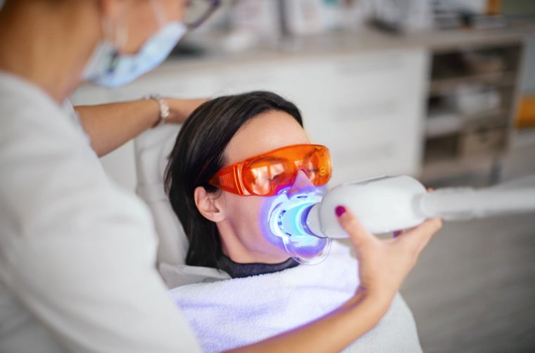 Tipps ästhetische Zahnmedizin 