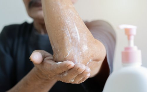 Liebe zum Duschen/kratzige Haut