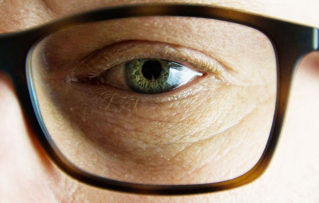 Es gibt viele Ursachen für trockene Augen.