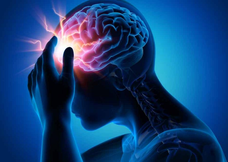 Migräne: Hilfe bei quälenden Kopfschmerzen