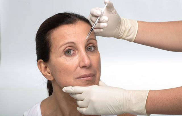 Falten mit Botox behandeln