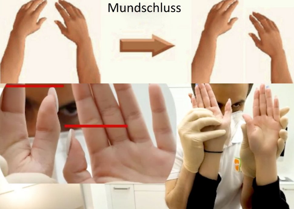 Funktioneller Armlängen-Differenztest 