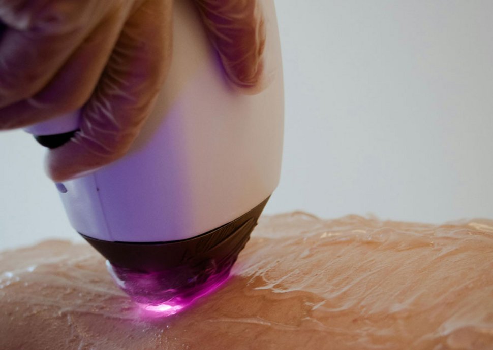 Dauerhafte Haar- und Tatooentferung.