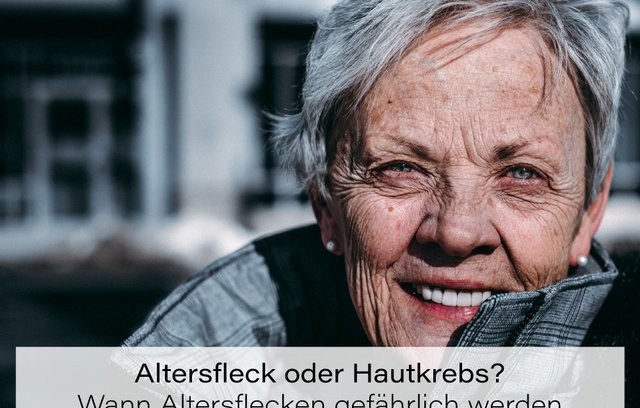 Ein Extrakt aus Kresse kann der Entstehung von Altersflecken vorbeugen.