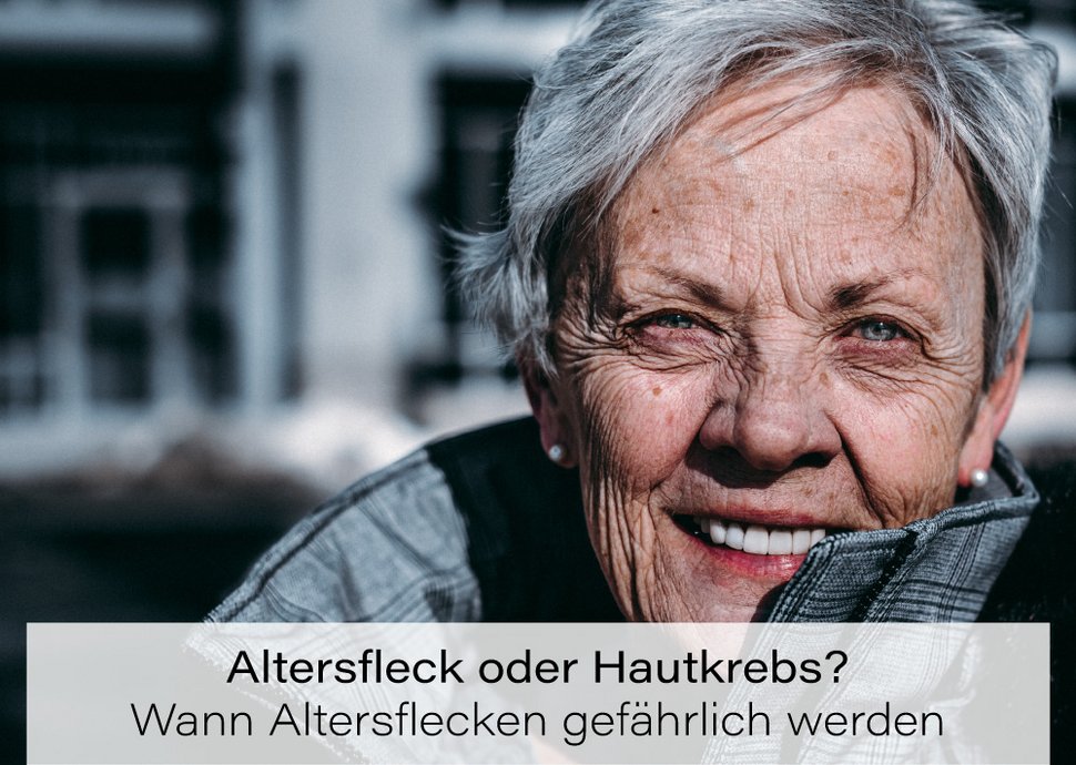 Ein Extrakt aus Kresse kann der Entstehung von Altersflecken vorbeugen.